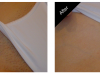 Bikini Hair Removal Carmel Indiana