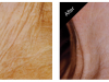 Anti Aging Treatments Carmel
