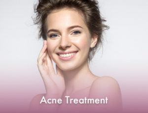 Acne-Treatment